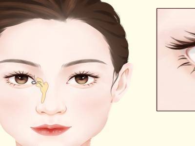 懷孕期需要避孕嗎 避孕方式有哪些