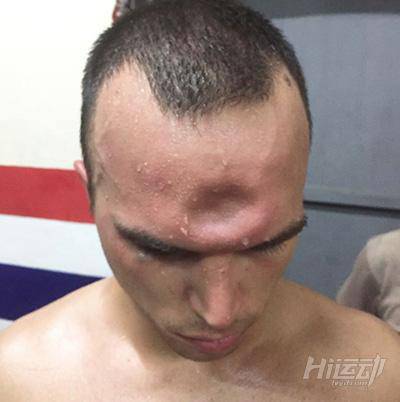 為什么終止比賽？我還沒(méi)打夠呢！