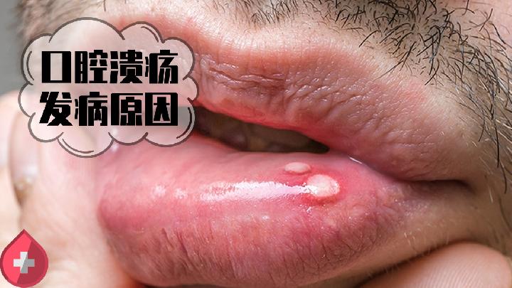 飲食減肥 談碳水化合物色變？6個理由告訴你不用怕