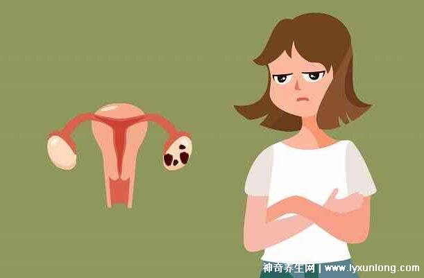 子宮肌瘤最怕三個(gè)運(yùn)動(dòng)，激烈的運(yùn)動(dòng)和夫妻生活導(dǎo)致肌瘤增大