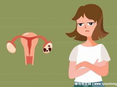 子宮肌瘤最怕三個運動，激烈的運動和夫妻生活導(dǎo)致肌瘤增大