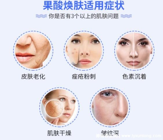 果酸換膚多少錢一次，1000-3000元不等(細致毛孔/淡化痘印)