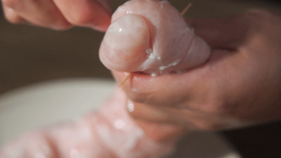 九轉大腸的做法-酸甜味燒菜譜-易網健康養生網 九轉大腸的做法-酸甜味燒菜譜