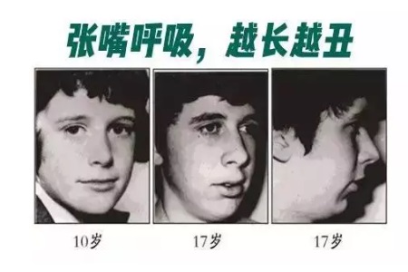 這些讓你變丑的習(xí)慣，再不改那可就沒救了！