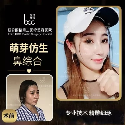 【隆鼻的“潛規則”】醫生是“看人收費的”?-易網健康養生網 【隆鼻的“潛規則”】醫生是“看人收費的”?