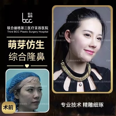 【隆鼻的“潛規則”】醫生是“看人收費的”?-易網健康養生網 【隆鼻的“潛規則”】醫生是“看人收費的”?