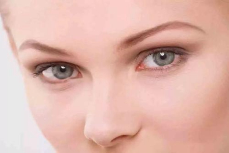 水腫、黑眼圈只是因為沒睡好？女性眼部問題潛藏的病癥