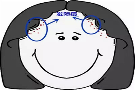 敏感肌的女性對護膚產生放棄心態，簡單的技巧做好恢復肌膚好狀態