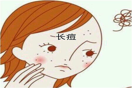 青春期女性長痘必非小事？可能要面臨的問題以及建議性護膚法