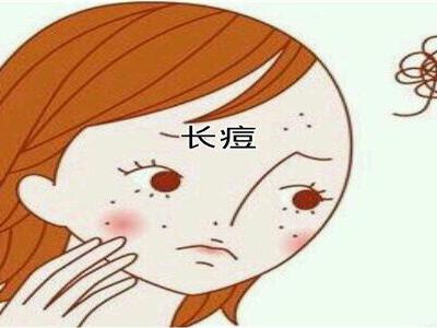 青春期女性長痘必非小事？可能要面臨的問題以及建議性護膚法