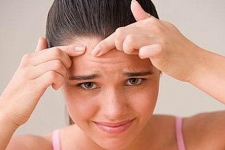 女生額頭長痘的原因，對癥下藥才能有干凈肌膚
