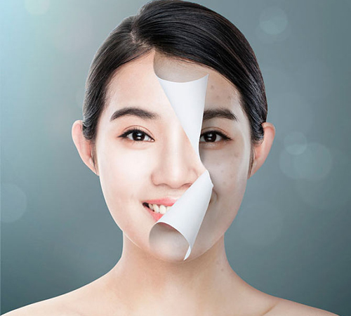 女人祛斑養(yǎng)顏的方法有哪些？4個方法讓肌膚凈白無暇