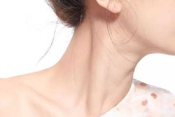頸紋是怎么形成的?怎么消除?