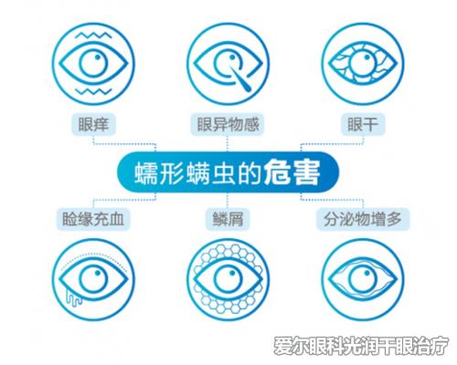 美妝達人全程直播干眼癥治療過程 光潤干眼治療效果獲