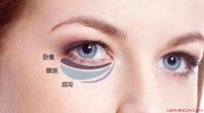 怎樣去除眼袋最有效的方法是什么 幾個(gè)實(shí)用小妙招推薦