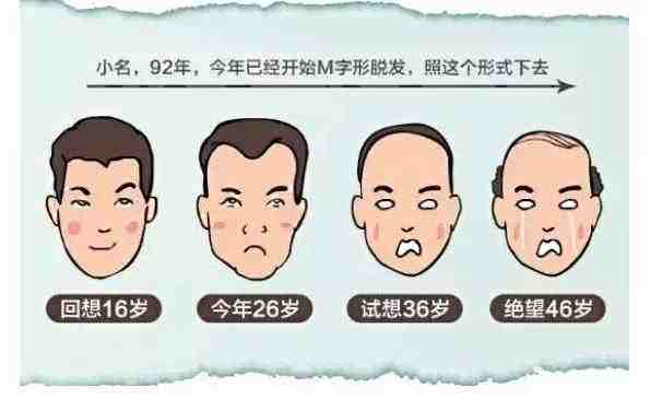沒有家族脫發史 我為什么年紀輕輕也禿了-易網<a href=http://www.aoa7937.com/ target=_blank class=infotextkey>健康養生</a>網 沒有家族脫發史 我為什么年紀輕輕也禿了