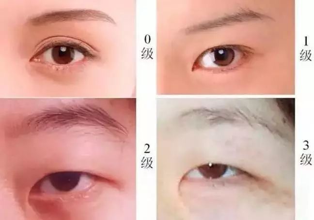 雙眼皮貼是在眼影之前還是之后？眼妝注意事項有哪些？
