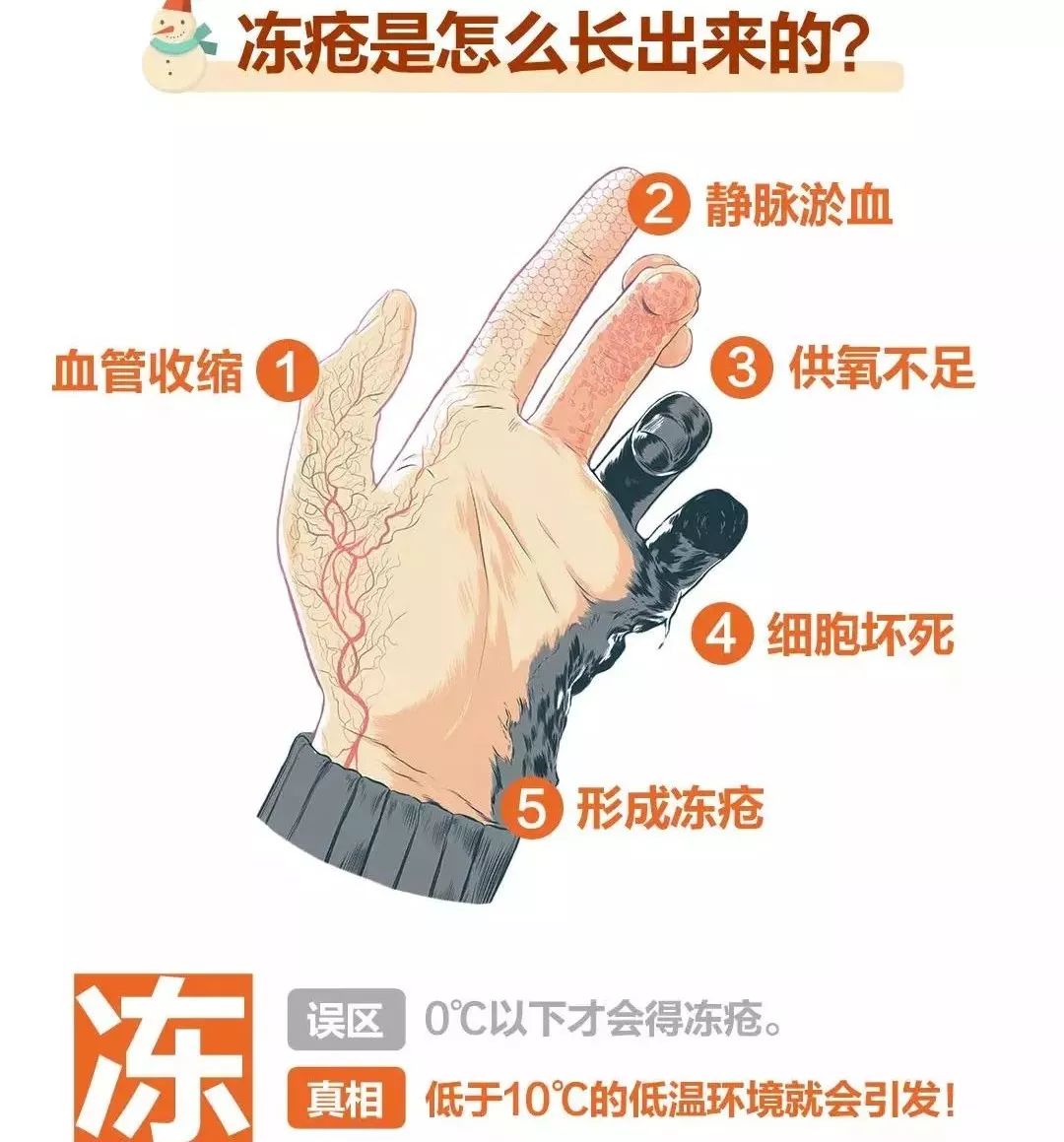 冬天天氣冷長凍瘡怎么辦？6個小妙招教給你