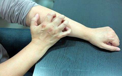 冬季皮膚瘙癢是怎么回事? 可能是6個(gè)因素在作怪