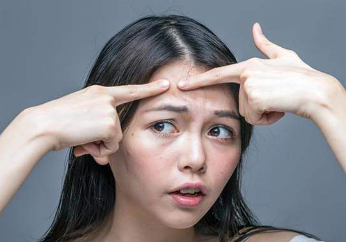 面部頻繁起痘是怎么回事？這4個原因要注意