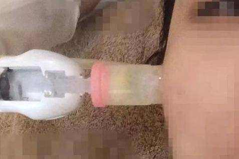 微針和水光針有什么區別?哪個治療效果會更好-易網健康<a href=http://www.aoa7937.com/jkys/ target=_blank class=infotextkey>養生</a>網 微針和水光針有什么區別?哪個治療效果會更好
