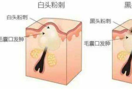 油性皮膚會有哪些肌膚問題 如何改善油性皮膚問題-易網<a href=http://www.aoa7937.com/ target=_blank class=infotextkey>健康養生</a>網 油性皮膚會有哪些肌膚問題 如何改善油性皮膚問題