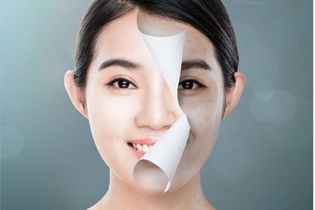女生油性皮膚怎么改善，防曬才是最重要的控油方法