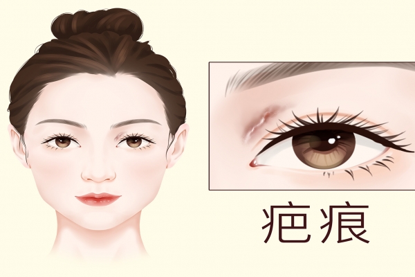 疤痕皮膚修復方法