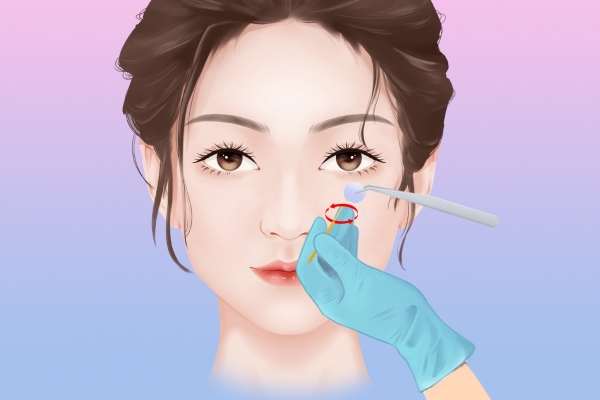 美白針打在哪里
