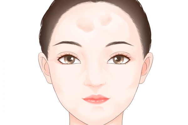 額頭有皺紋怎么回事