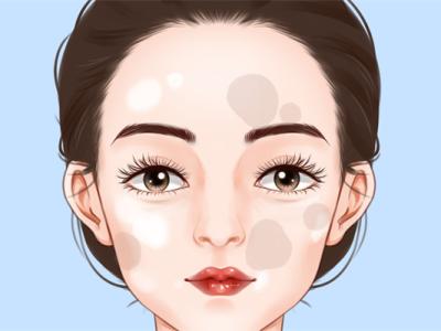 光子祛斑多少錢(qián)一次