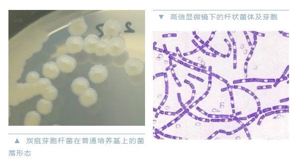 警惕炭疽，和新冠同一等級傳染病！