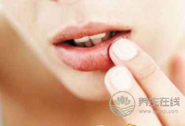 預(yù)防秋季爛嘴角的方法有哪些