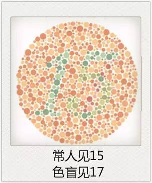 與視力相關(guān)的一些眼疾 與視力相關(guān)的一些眼疾
