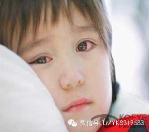慢性結(jié)膜炎的原因有哪些? 慢性結(jié)膜炎的原因有哪些?