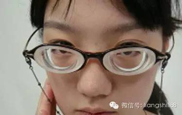 警惕，高度近視眼底病變
