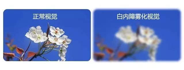 中老年人患白內障的真相是什么？