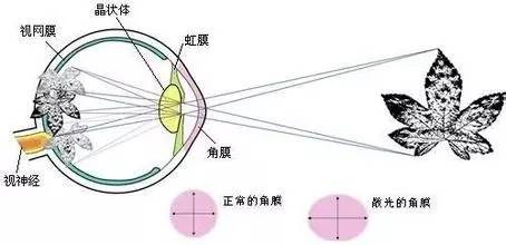 關于散光，這些你都了解嗎？
