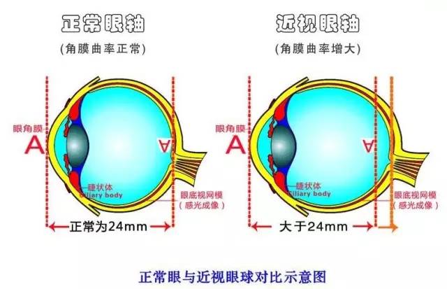 孩子近視度數(shù)猛漲？近視防控小心誤區(qū)！