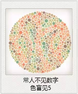 與視力相關(guān)的一些眼疾 與視力相關(guān)的一些眼疾