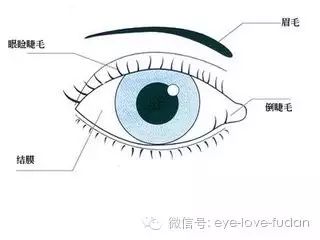 倒睫是怎么回事？自己可以用鑷子拔嗎?