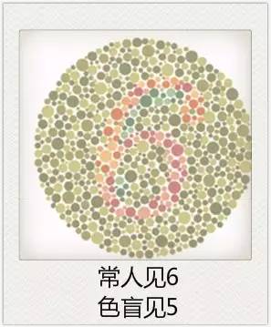 與視力相關(guān)的一些眼疾 與視力相關(guān)的一些眼疾
