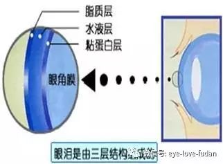 干眼癥就是眼睛缺水嗎？
