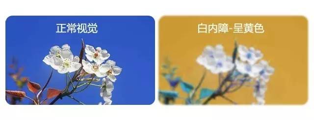 中老年人患白內障的真相是什么？