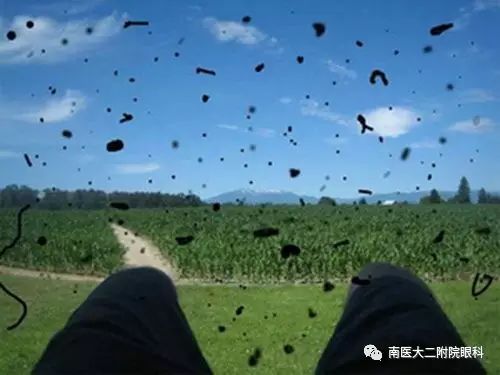 患病率最高的三種眼睛疾病