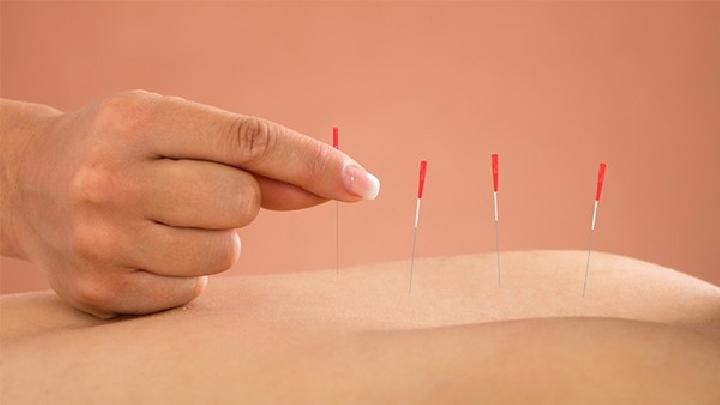 得了急性乳腺炎怎樣針灸治療 女性急性乳腺炎有什么癥狀表現