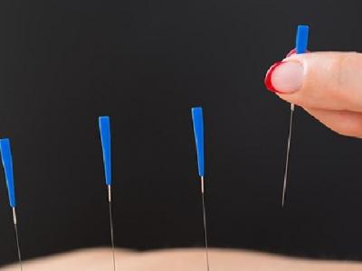 中醫(yī)針灸治療痛經(jīng)效果好嗎 中醫(yī)針灸治療痛經(jīng)需了解三方面