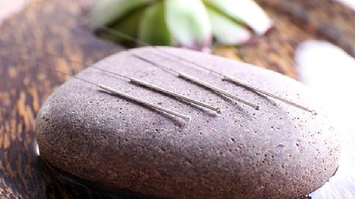 針灸對(duì)痤瘡的治療有效果嗎？中醫(yī)針灸的去痘方案介紹