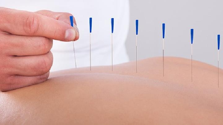 確診大腸癌的10個癥狀表現 8個大腸癌的針灸療法介紹