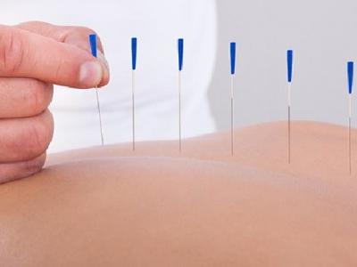 確診大腸癌的10個(gè)癥狀表現(xiàn) 8個(gè)大腸癌的針灸療法介紹